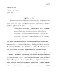 Organ Sales and ethics