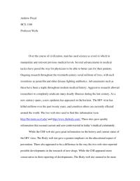 History of Aid’s