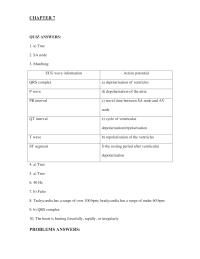 Chapter 7 Homework Interpretation Sinus Tachycardia First Determine The Resultant