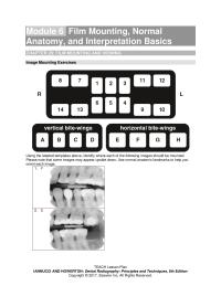 Dentistry Chapter 06 Module Film Mounting Normal Anatomy And Interpretation