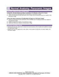Dentistry Chapter 29 On a panoramic image the ear is viewed superimposed
