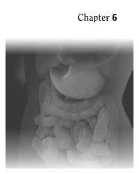 Dictionaries Chapter 6 Autoimmune condition in which villi in the small