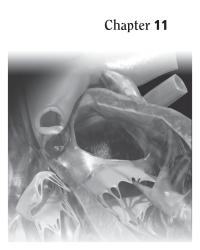 Dictionaries Chapter 11&nbsp;sulcus sympathetic nerves synapse thalamus